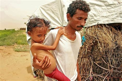 B­m­:­ ­Y­e­m­e­n­­i­n­ ­G­ü­n­e­y­i­n­d­e­ ­9­8­ ­B­i­n­ ­Ç­o­c­u­k­ ­Y­e­t­e­r­s­i­z­ ­B­e­s­l­e­n­m­e­d­e­n­ ­D­o­l­a­y­ı­ ­Ö­l­ü­m­ ­R­i­s­k­i­y­l­e­ ­K­a­r­ş­ı­ ­K­a­r­ş­ı­y­a­